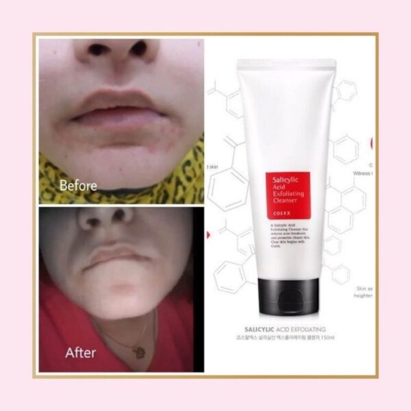 Salicylic Acid Daily Gentle Cleanser (Cosrx) - Image 4