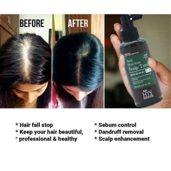 HTS Anti Hair Loss Scalp Tonic-150ML - Image 3