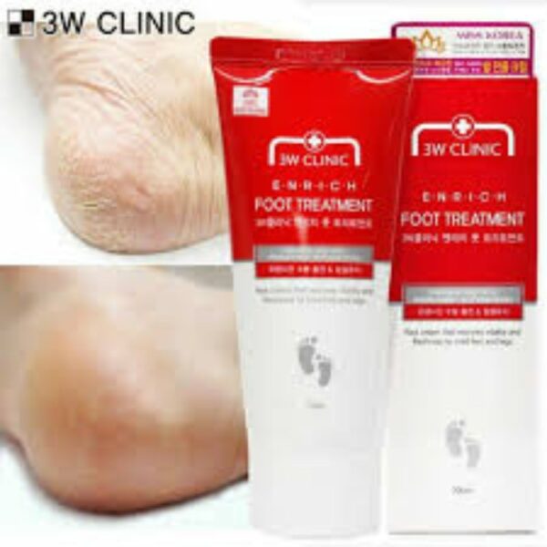 3w Clinic Enrich Foot Treatment-100ML - Image 4